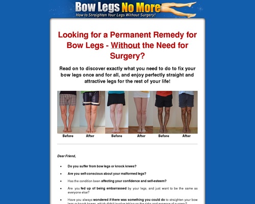 Bow Legs No More – Hot For Year 2020!