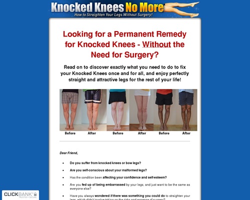Knocked Knees No More – Hot For Year 2020!