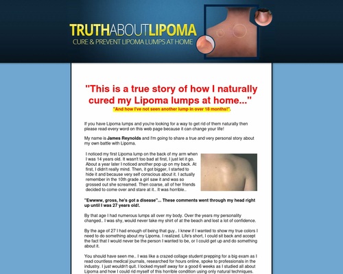 New! – Truth About Lipoma. High Conversions + 75% Commission!