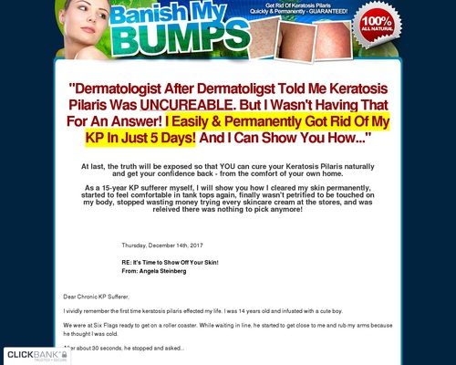 Keratosis Pilaris Cure – 75% Commission – 1:17 Conversion Rate